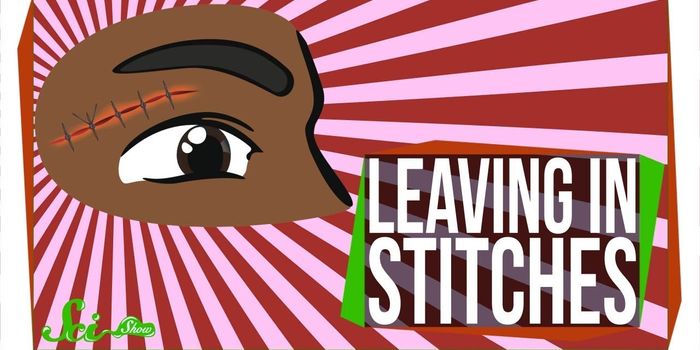 Don't Want a Weird Scar? Get Those Stitches Out!