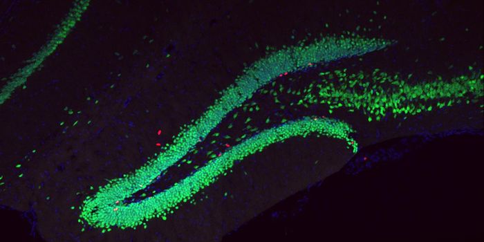 Does Lactate Explain Why Exercise Can Relieve Depression?