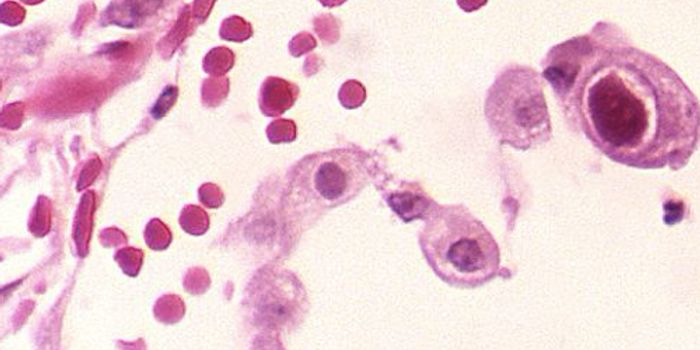 Chipping Away at the Mystery of Viruses