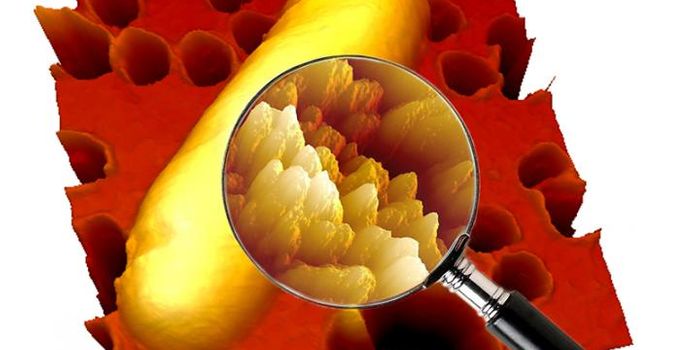 Progress in the Fight Against Killer Superbugs