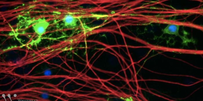 Genetic Variant Study Links Brain Cells to Multiple Sclerosis