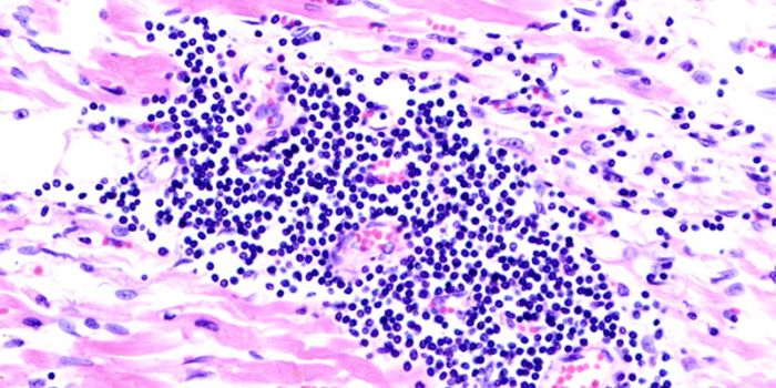 Single Cells to Thank for Rebuilding Blood Vessels