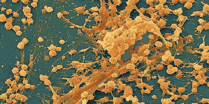 Stop Biofilms Before They Start