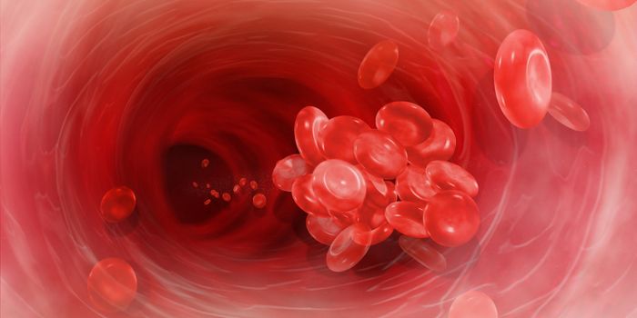 New Guidelines For Treating Venous Thromboembolism