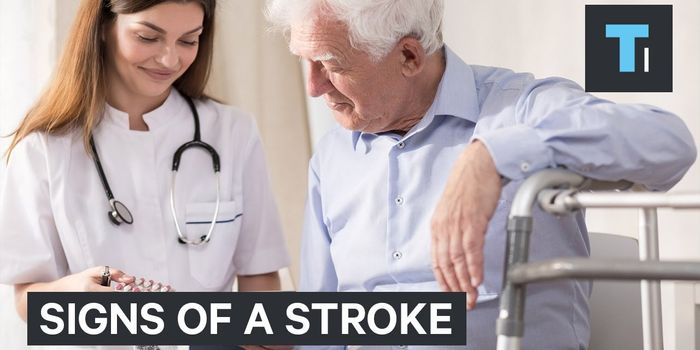 Think 'FAST' in a Stroke Situation