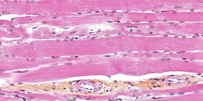 Obesity Exerts an Epigenetic Effect on Muscle Stem Cells