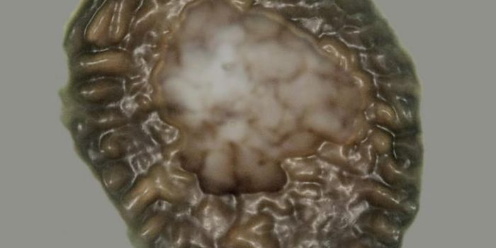 Is This the Missing Link?