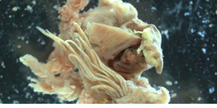 Brain-infecting Parasite Rises at 'Alarming' Rate in Florida