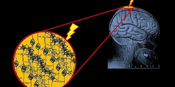 DIY Brain Zapping Is A Bad Idea