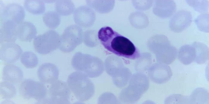 A Major Step Toward a Vaccine for Severe Malaria