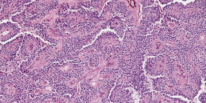 A Natural Killer to Eliminate Cancer Cells