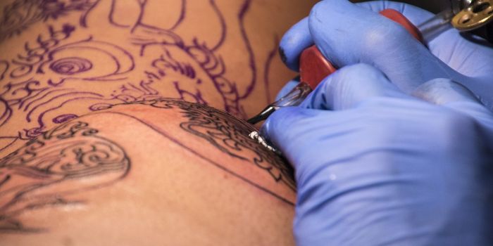 Nontuberculous Mycobacterial Infections in Tattoos