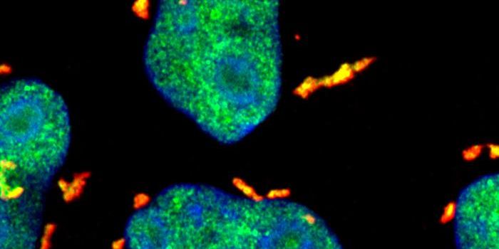 How Daughter Cells Protect Themselves From Parents' Harmful Baggage