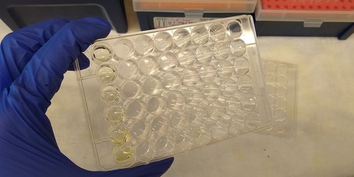 Simple Test Rapidly Diagnoses Antibiotic-resistant Infections