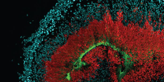 Why Neural Stem Cells Could be Vulnerable to Zika