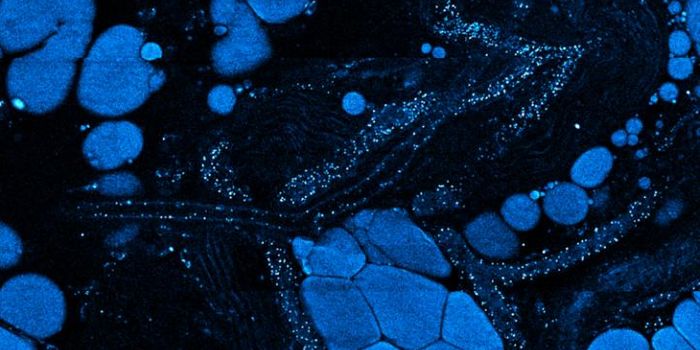 New Details About how Cells Change as Tumors Develop