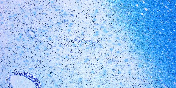 NOD2 Pathway Linked to Crohn's Disease and Multiple Sclerosis