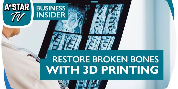 Repairing Broken Bones With 3D-Printed Scaffolds
