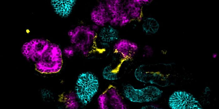 Mini-Kidneys Reveal New Insights, Treatments for Multiple Disorders