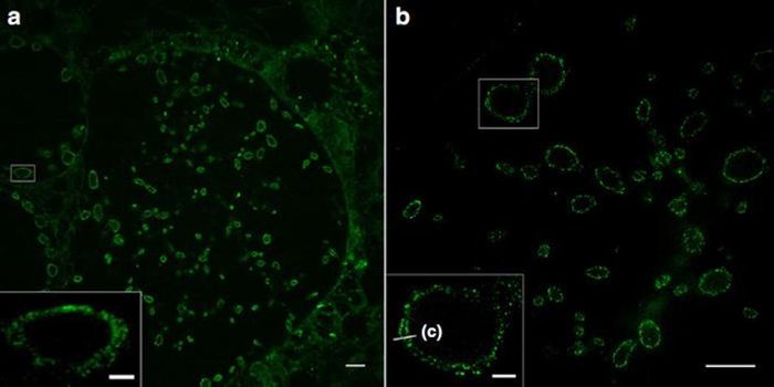 Expanding Our View of Cell Membranes