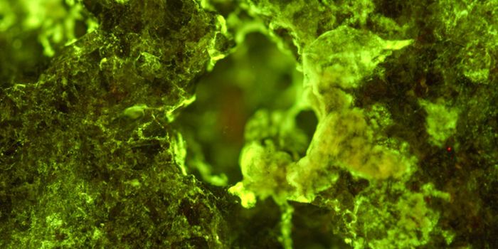 Mining Metal From Microbes in Space