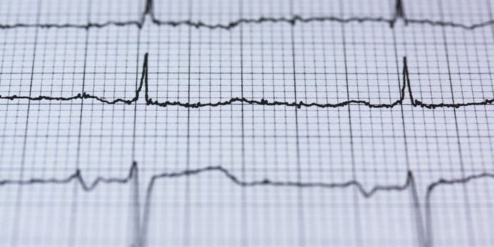 Cardiac Mapping for Arrhythmia Diagnosis
