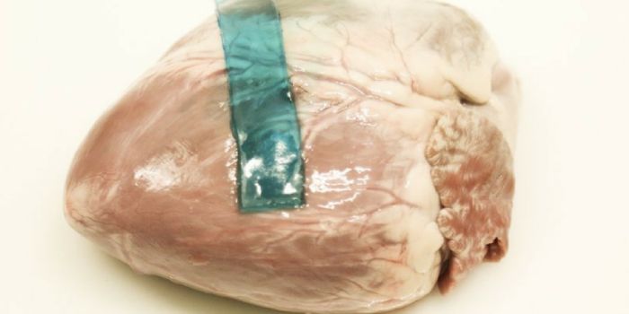 Slime from European Slug Inspires New Surgical Glue