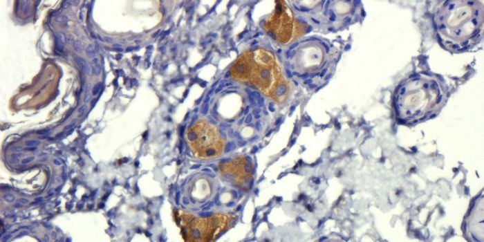 TGF-Beta Targeted by New Antibody-Based Therapy