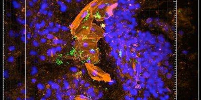 New Technique - MiPACT - Makes Infections Visible