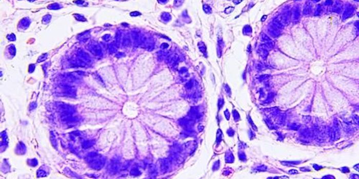 Mechanism of Aspirin's Anti-Colon Cancer Effects Revealed