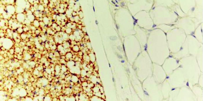 Can Melting Brown Fat Fight Obesity?