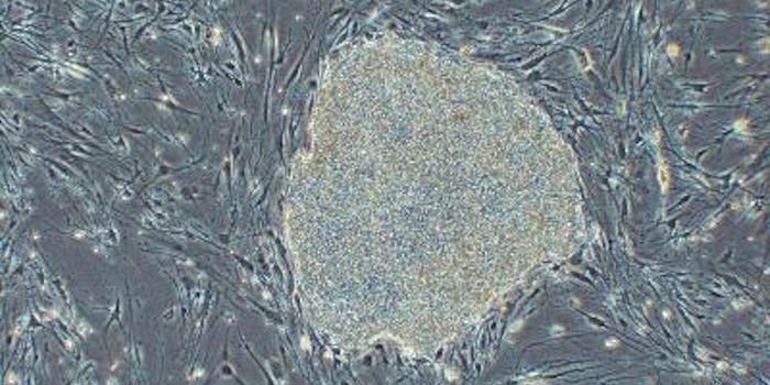 New Research Efforts to Create Human-Monkey Chimeras