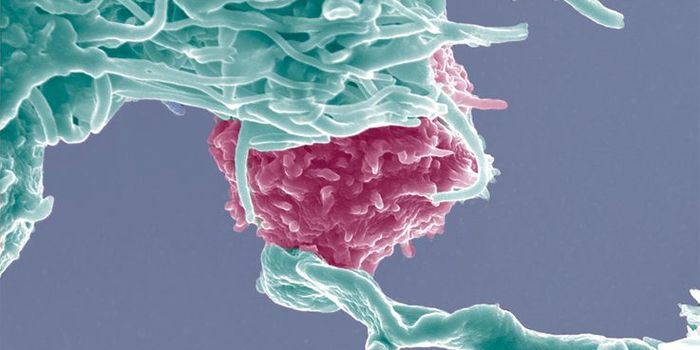 Reprogramming Naive T Cells to Attack Cancerous B Cells