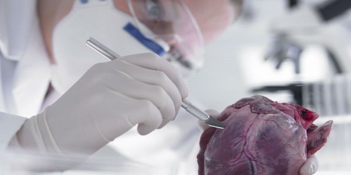Patch It Up: Stem Cell Heart Patch Close to Human Trials