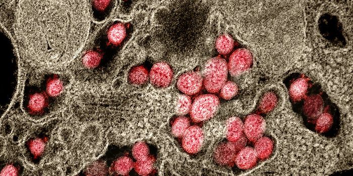 Are Ventilators Making Some COVID-19 Patients Worse?