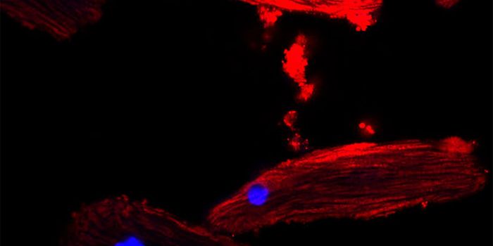 Stressed Mitochondria From Fat Cells Are a Warning to the Heart