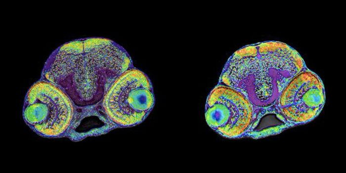 Why Mutations in RRP7 Cause a Congenital Brain Disorder
