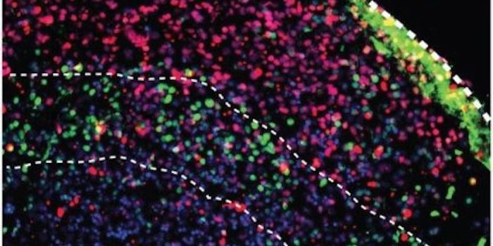 3-D Brain Models Could Be Diagnostic Tool for Doctors