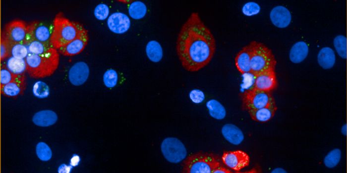 Genetic Variant Explains Paradoxical Link Between Diabetes and Heart Disease