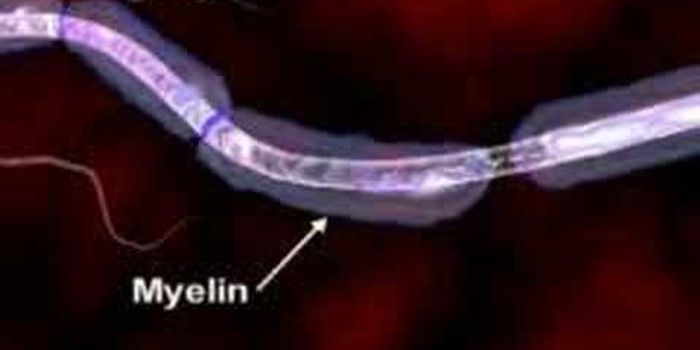 What is Multiple Sclerosis 