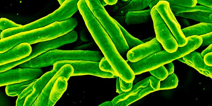 As Tuberculosis Cases Spike in California, Therapeutic Enzymes Are ID'ed