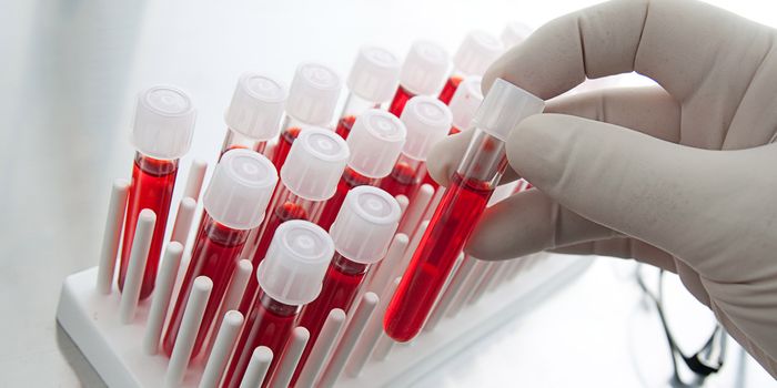 Cardiac Troponin T Assay Improves Heart Disease Diagnoses