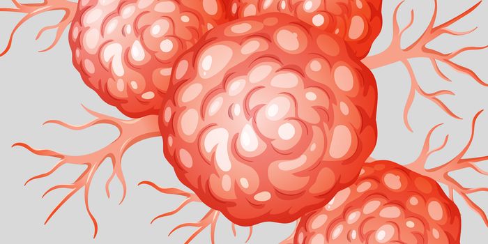 Energy Depletion Dysregulates Antitumor Immunity