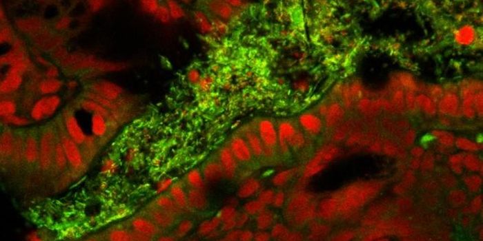 Early Environment and Genes Shape the gut Microbiome