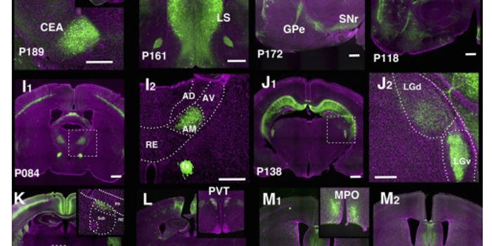 New Technique To Find and Alter Cell Types in Brain