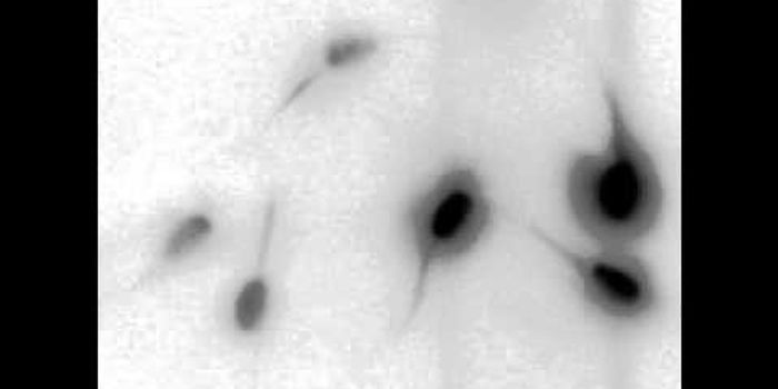 Slithering Sperm to Improve Fertility Odds?