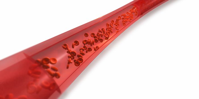 Getting to the Bottom of Blood Vessel Failure