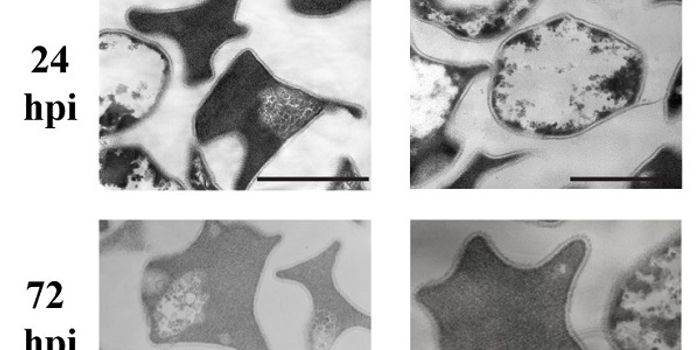 Microbes Scared to Death by Virus Presence