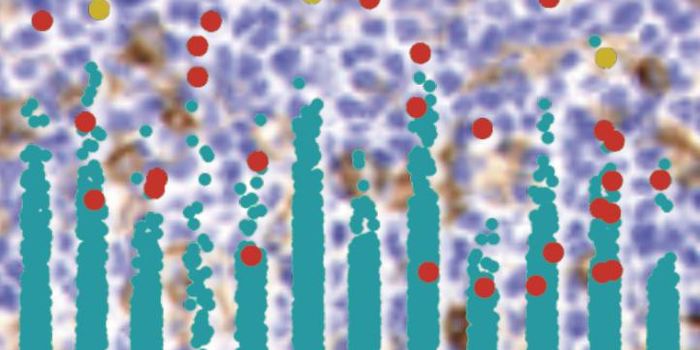 Alteration of "Programmed Death Ligand" Promotes Cancer Metastasis
