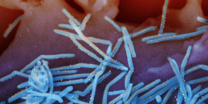 Genes Responsible for Infant Bronchiolitis Identified